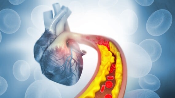 reduce cholesterol