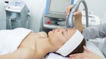 Laser skin tightening