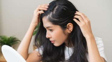 Stem cell therapy for hair loss